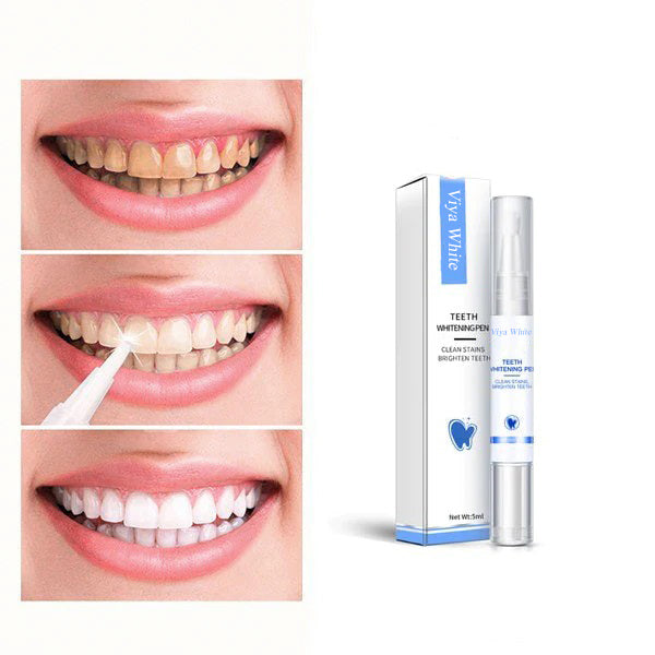 Fast Teeth Whitening for a Radiant Smile
