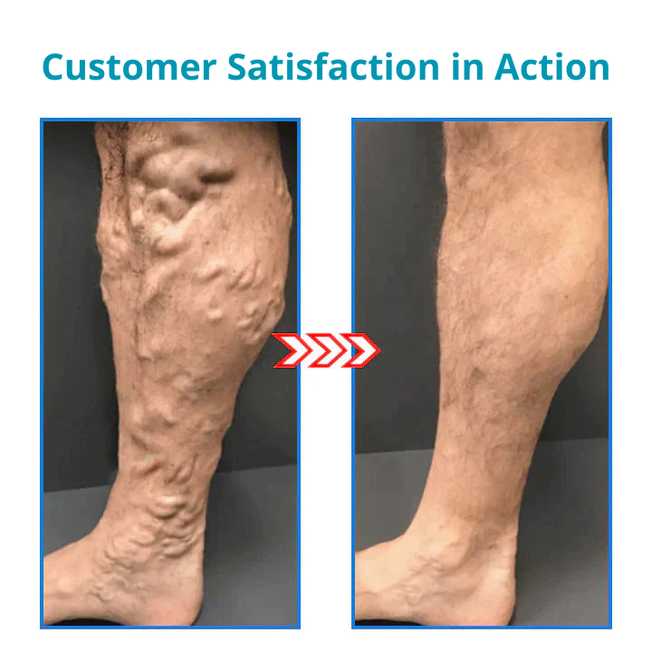 ShapeSocks™ 1+1 Free – Slimmer Legs & Firmer Skin in One Step!