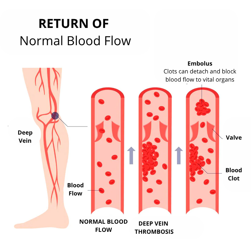 ShapeSocks™ 1+1 Free – Slimmer Legs & Firmer Skin in One Step!