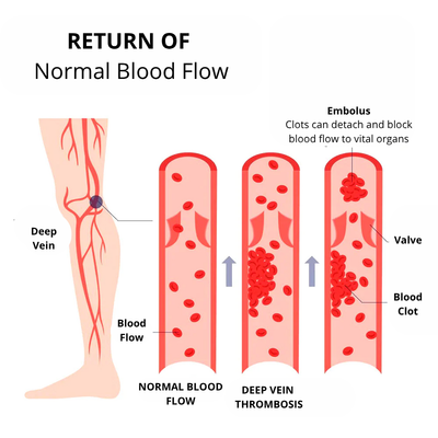 ShapeSocks™ 1+1 Free – Slimmer Legs & Firmer Skin in One Step!